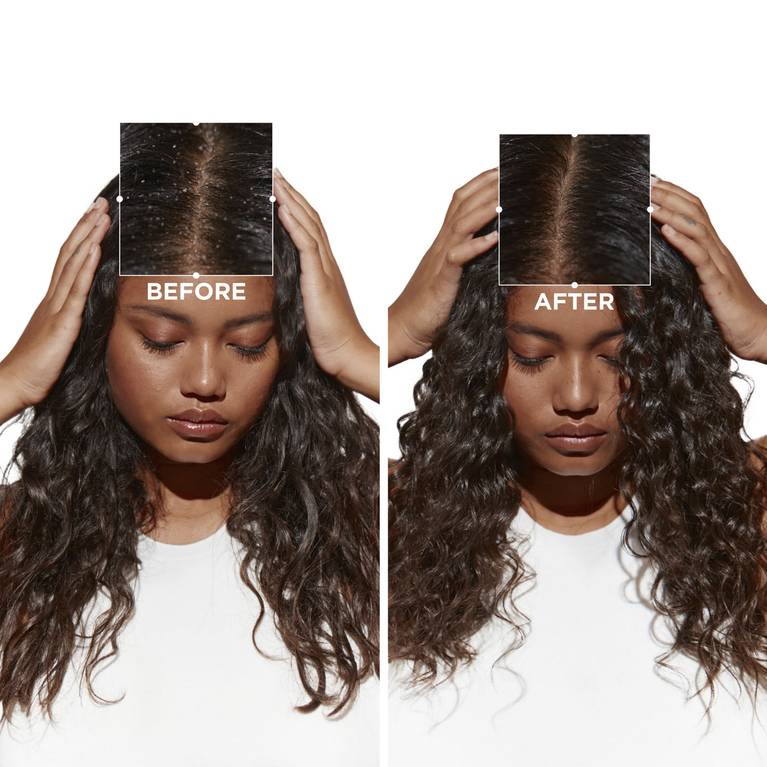 Kérastase - Kérastase Symbiose Bain Crème Anti-Pelliculaire Shampoo - 250ml - Freshhair.dk